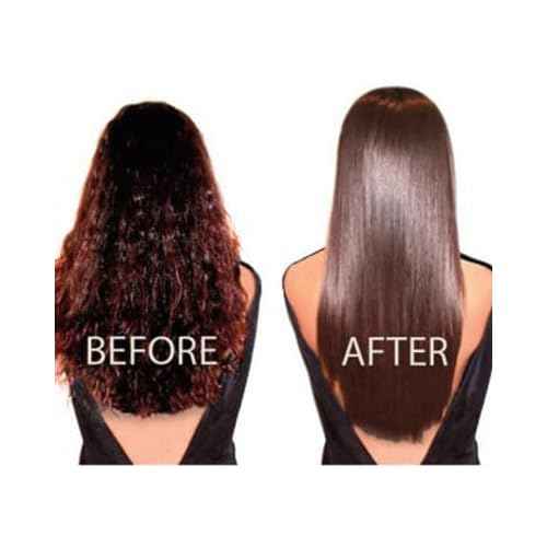 Brazilian HAIR SURGERY reatment Hair Liss Kit 32oz/960ml - At Home Keratin Treatment Smoothing and Straightening - Keratina para Alisar el Pelo - For All Hair Types Cirugia Capilar para el cabello