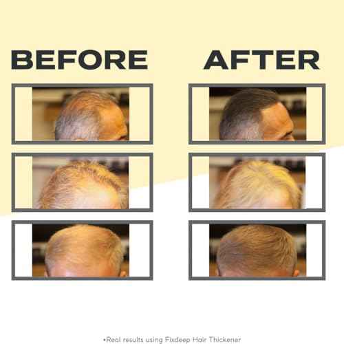 Hair Thickener | New Waterproof Formula - Natural & Fuller Looking Hair in 30 sec - 14g - Fibers for Thinning, Bald Spots & Graying Roots (Dark Brown)