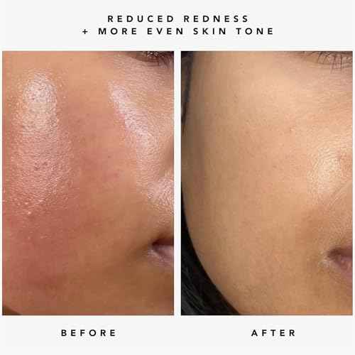 HERBIVORE Nova 15% Vitamin C + Turmeric Brightening Serum for Dark Spots, Hyperpigmentation + Even Skin Tone | Vegan, Plant-Based, Cruelty-Free, 30 mL / 1 oz