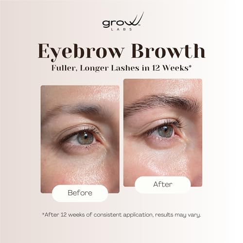Eyebrow Growth Serum ? with Biotin & Peptides ? Regrow Eyebrow Hair ? Nourishing Formula for Thicker, Fuller, Natural-Looking Brows ? Vegan, Cruelty-Free ? Made in USA ? 5 ml