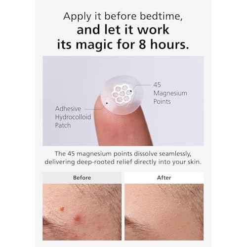 EasyDerm Quick Calming Magnesium Patches ? 40 Patches (4 Pack), Hydrocolloid Acne Spot Treatment with Tea Tree & Cica, Bulk Value Pack for Acne-Prone Skin, Ideal for Home Skincare