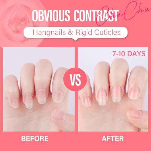 CHUCHU Jojoba Cuticle Oil for Nails: Watermelon Organic Nail Oil with Vitamin B & E - Moisturizes Repairs and Promotes Nail Growth - Prevents Dryness Hangnails and Chapped Skin 15ML