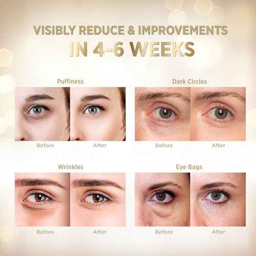 VELAMO ADVANCED Under Eye Patches: 24K Gold Under Eye Mask for Puffy - Retinol Patchology Eye Patches for Wrinkles and Dark Circles Puffiness- Collagen Under Eye Bags Treatment for Women Men 60 Pcs