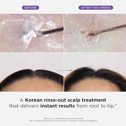 Dr. Groot Miracle in Shower Treatment, Korean Hair Care, 5 Seconds to Smooth Hair, Rosemary Oil for Healthier-Looking Hair, Hair Rinse, Moisturizing Hair Treatment, Kbeauty Scalp Revitalizing Solution