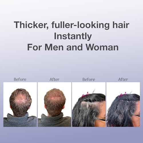 BosleyMD BosVolumize Hair Thickening Fibers, Hair Building Formula with Natural Keratin for Thinning Hair or Bald Spots, Hair Loss Concealer Men and Women, 4 Colors