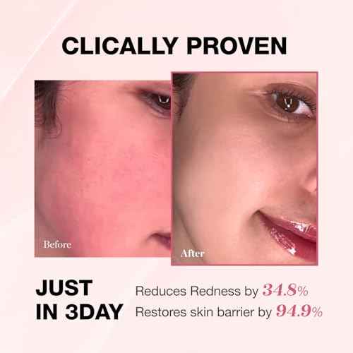 Physiogel Redness Reducing Cream ? Ceramide Moisturizer for Dry, Sensitive & Redness-Prone Skin, Repairs Skin Barrier, Dermatologist-Tested, Fragrance-Free, Korean Skincare, 1.69 fl oz