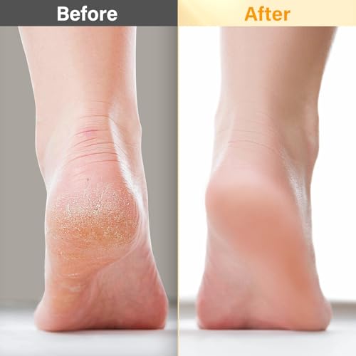Pedicure Kit For Feet 5pcs Foot Spa Set For Christmas Birthday Valentine's Mother's Day Women Wife Girlfriend Gift Rose Lavender Foot Soak Salt Foot Callus Remover Gel Foot Rasp Foot Cream Foot Care