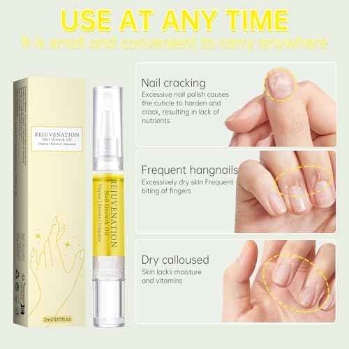 Fiorland Nail Growth Oil, Rejuvenation Nail Growth Oil, Instant Nail Repair, Rejuvenation Serum for Nail Strengthener and Growth (2PCS)