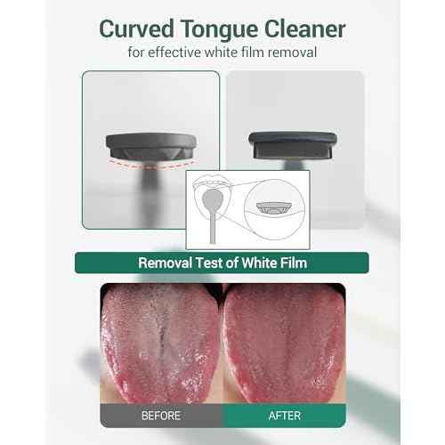 DEARCUS Korean Tongue Scraper with 3 Replaceable Heads - 100% BPA Free TPE Tongue Cleaner - Reduce Bad Breath & Without Hurt - Hygienic Scraper - Modern & Simple Design (White)