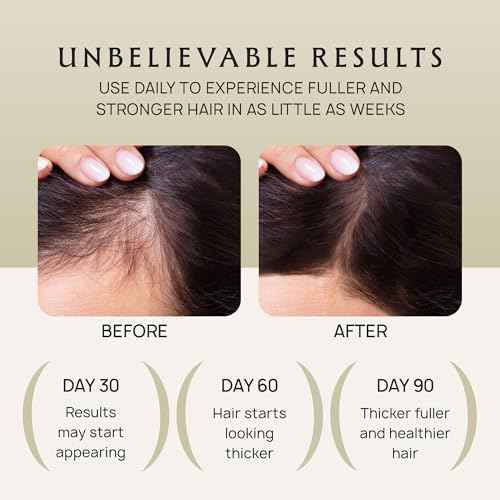 Hair Growth Oil Spray - 100% Pure Ingredients For Non Greasy, Thicker & Stronger Hair - Organic Batana, Castor, Biotin, Saw Palmetto, and Rosemary Oil Gifts for Men & Women Scalp - 4.1 Fl Oz