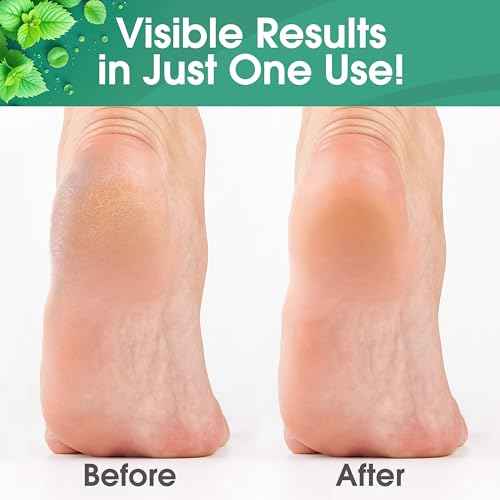 Callus Remover for Feet, Extra Strength Foot Callus Remover Gel, 16oz Salon Grade Home Pedicure Supplies for Dry Skin, Cracked Heel, Professional Strength Foot Care, Cool Mint