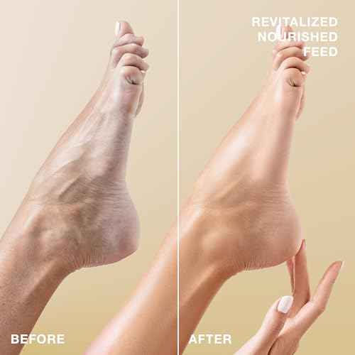 STARSKIN VIP Gold Mask Foot (4 Pieces), Softening Foot Mask for all Skin Types, Korean Skin Care, Hydrating and Moisturizing with Shea Butter and Rose Oil, K Beauty Skincare