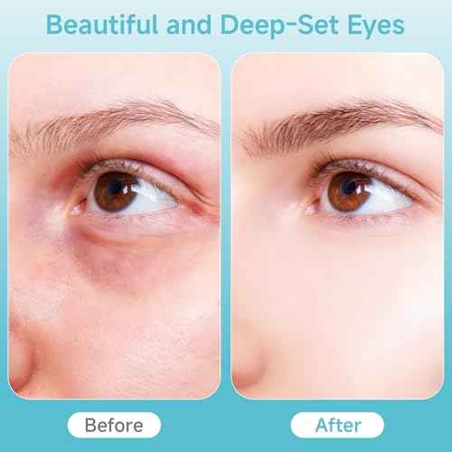 Eye Care Wand, Cold and Hot Skincare Treatment,Face Roller and Eye Massager for Eye Puffiness,Dark Circles and Glow; Depuffing Wand,Facial Skin Care Tools for Women Men (White)