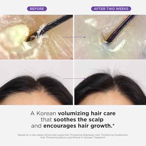 Dr. Groot Hair Essentials Set for Hair Loss, Thinning Hair, Hair Repair and Growth with Biotin and Rosemary, Clinically Tested, Scalp Treatment
