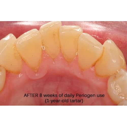 Periogen Complete Oral Health Rinse (3-PK)
