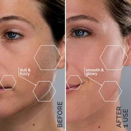 Michael Todd Beauty - Sonicsmooth Pro+ Dermaplaning Blade Refills - 8 Dermaplaning Blades- 2 Month Supply - Device Not Included