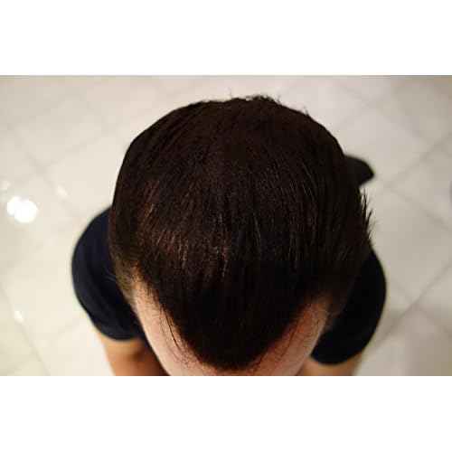 Finally Hair Building Fiber Refill 100 Grams Hair Loss Concealer by Finally Hair (Medium Brown)