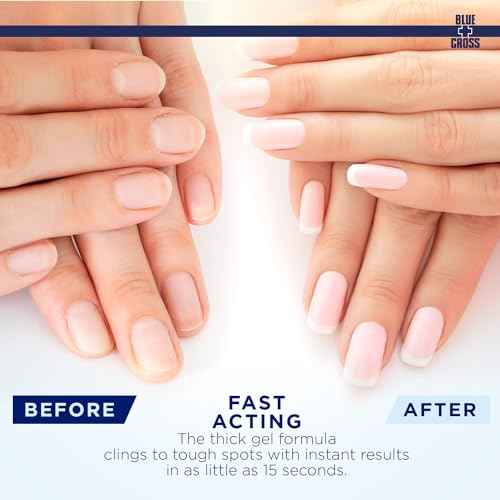 Blue Cross Cuticle Remover Liquid Gel, Cuticle Softener for Nails, Hydrating, Moisturizing, Professional Nail Care for Brittle Hang Nails, Dry Cuticles, Made in USA, 8oz, Eucalyptus/Tea Tree