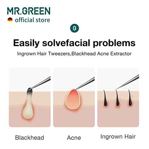 MR.GREEN Ingrown Hair Tweezers Needle Nose Pointed Tips Tweezers For Eyebrows Splinters Blackhead Removal Acne Clip Extractor (Long)
