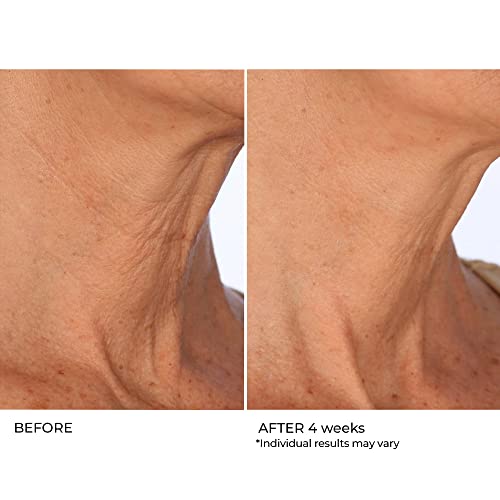 NassifMD Age Defying Neck & D?collet? Serum, Lifts and Firms Thin Neck Skin, Hydrates and Smooths