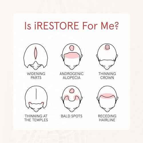 iRESTORE Biotin Hair Conditioner for Damaged Dry Hair - Good for Fine Hair Growth, Volumizing Thickening Conditioner with Ginseng & Argan Oil to Moisturize, Pair With Hair Loss Shampoo