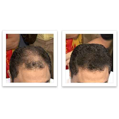 Caboki Hair Building Fiber + Built-In Spray Applicator (30-50 days supply). Dark Brown
