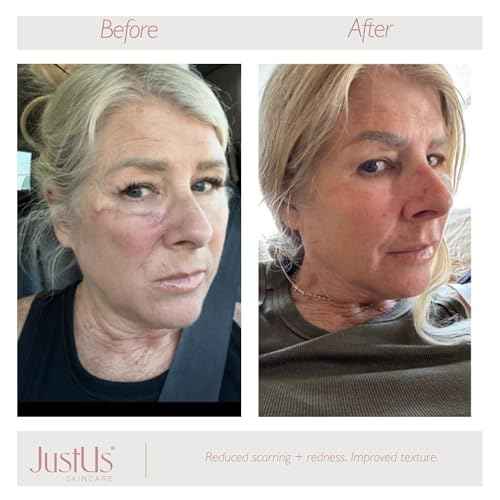 June Jacobs Anti-Aging Blemish Control Spot Treatment, 0.5 Fl Oz