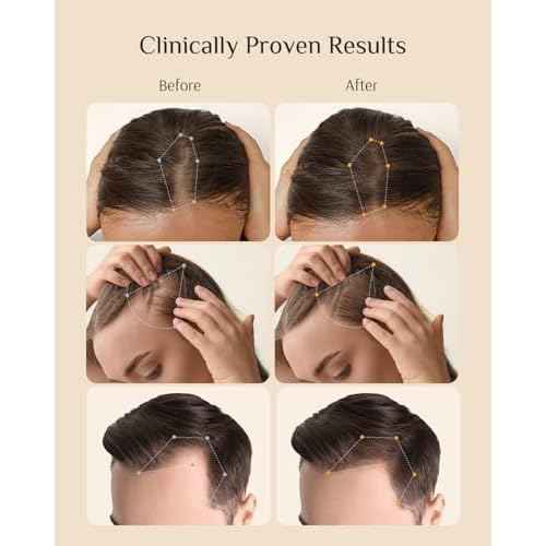 DR ZERO REDENICAL Hair Growth Shampoo for Women, 13.5 oz/400ml, Volumizing Thickening & Anti Hair Loss Regrowth Treatment, Clinically Tested for Hair Thinning with Redensyl, Japanese Hair Care Product