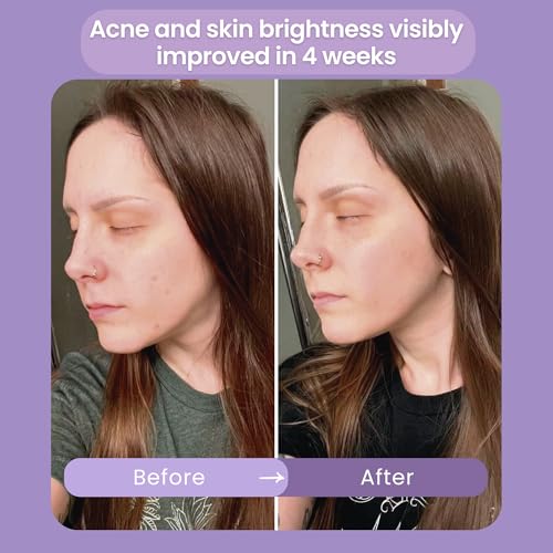 Infinite Aura Face Moisturizer ? Facial Lotion for Women; Hyaluronic Acid + Ceramide Wrinkle Barrier Repair Cream, Beta-Glucan Redness Relief, Copper Peptide Firming Anti Aging Day-Night