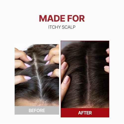 Kundal Caffeine Scalp Tonic - Anti hair loss, Soothes Scalp, Hair Thickening, Stimulates Hair Follicles, with Vitamin B3, Tea Tree & Peppermint Oil, 3.38 Fl Oz (100ml) Stocking Stuffers, Hair growth