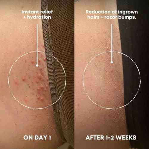 Bushbalm Ingrown Hair Exfoliating Scrub ? Pre-Shave Sugar Scrub for Ingrown Hairs, Razor Bumps & Dry Skin ? Gently Buffs & Soothes Sensitive Skin ? Nude, 236ml