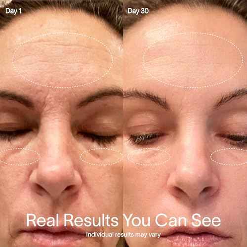 Solawave 4-in-1 Radiant Renewal Red Light Therapy Wand & Renew Complex Activation Serum | Beauty Device for Face & Neck | Serum Boosts Anti-Aging Effects, Reduces Wrinkles, Dark Circles & Puffiness