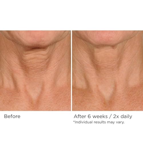 NassifMD Deco-Lift Neck Firming Complex Serum