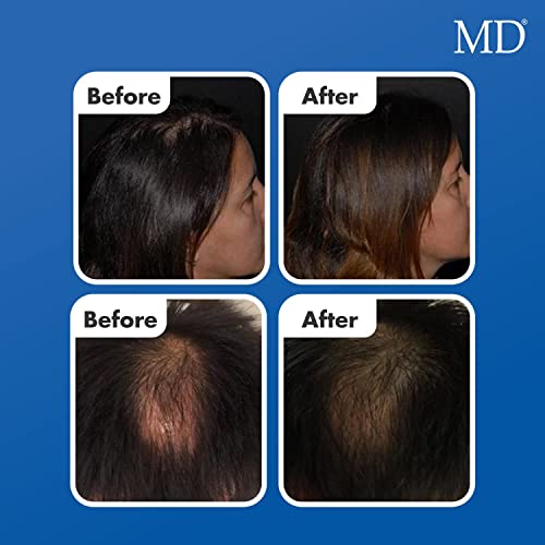 MD Follicle Energizer Natural Hair Growth Serum | Follicle Energizer Serum - Prevents Thinning Hair & Hair Loss By Stimulating Hair Follicles To Produce Thicker, Fuller Hair (30-Day Supply Per Tube)