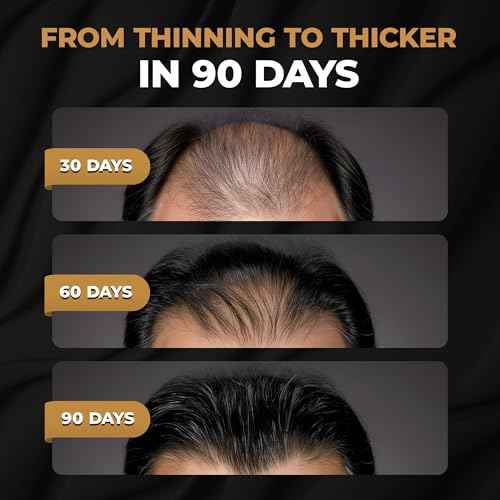 SPARTAN¢â Root Activator Conditioner For Men - Hair Growth Conditioner, Thickening Hair Moisturizer for Hair Loss and Thinning Hair