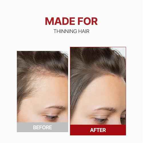 Kundal Caffeine Scalp Tonic - Anti hair loss, Soothes Scalp, Hair Thickening, Stimulates Hair Follicles, with Vitamin B3, Tea Tree & Peppermint Oil, 3.38 Fl Oz (100ml) Stocking Stuffers, Hair growth
