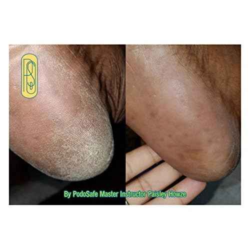 12 oz PodoSafe