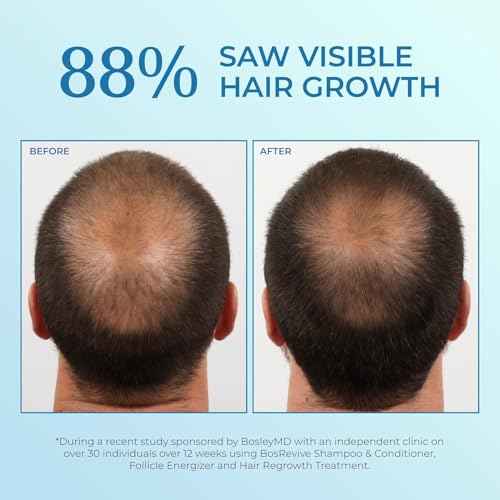 BosleyMD Minoxidil Foam, Extra Strength Thinning Treatment for Hair Loss and Hair Regrowth for Men, Women 5% Topical Solution, Foam/Mousse, 1-month supply, 2 oz.