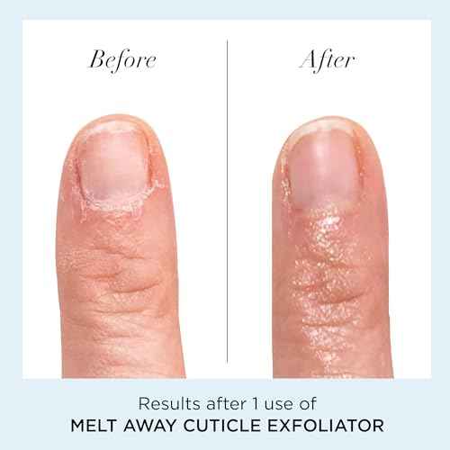 butter LONDON Cuticle Remover Liquid, Melt Away - Cuticle Softener Oil Exfoliator Gently Removes Dry & Overgrown Skin - Nail Care for Clean & Healthy-Looking Nails, Home Manicure & Pedicure
