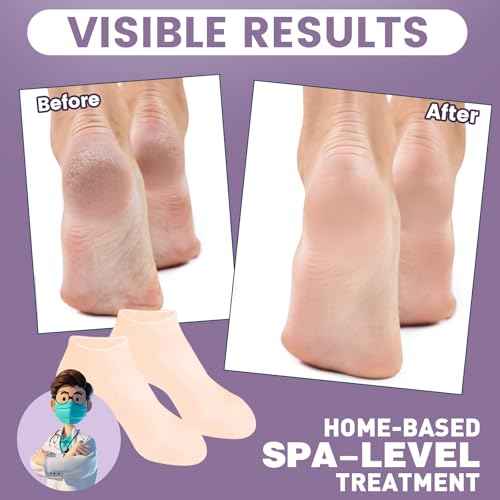 5 Pairs Silicone Socks for Dry Cracked Feet, Women's Foot Socks for Moisturizing (Beige, Fits Up to Size 9)