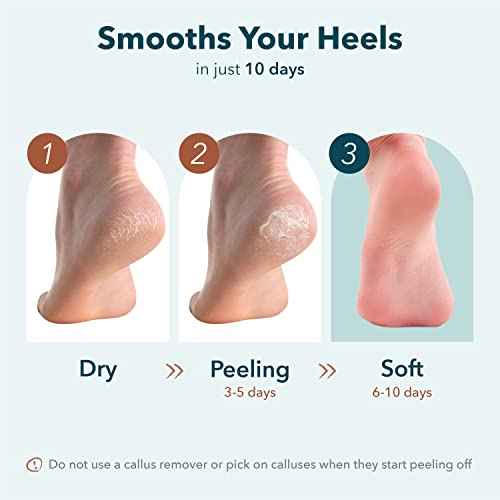 Purederm Exfoliating Heel Mask (1 Pair) ? Heel Peeling masks gently remove calluses from your heel