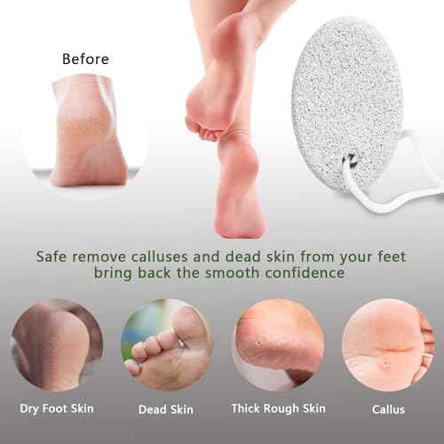 4-Pack Natural Pumice Stone for Feet, Borogo Lava Pedicure Tools Hard Skin Callus Remover for Feet and Hands - Natural Foot File Exfoliation to Remove Dead Skin, Heels, Elbows, Hands