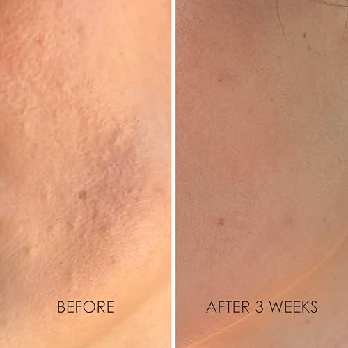 REFLEKT 3 Power Peptide Sculpting Face Cream