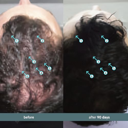 DS Labs Spectral Booster (formerly Spectral.F7) Hair Density Serum, 60mL - Non-Greasy, Leave-In, Supports Fuller, Thicker, Looking Hair, with Astressin-B Peptide & Copper Peptides, Water-Based