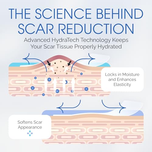 Medical Grade Silicone Scar Sheets - Long Water-Resistant Silicone Scar Tape - Advanced Solution for Surgical Scars, Stretch Marks, and Keloids - 7-Inch Strips, 12-Pack