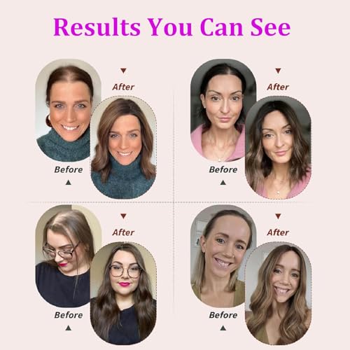 Hair Toppers for Women Real Human Hair, 4x4.8 Inch Upgrade Basement 360¡Æ Cover 3D Clip in Hairpieces for Women with Thinning hair, 14 Inch 2# Dark Brown