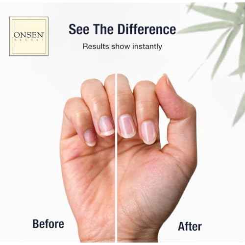Onsen Nail & Cuticle Cream Treatment w/Japanese Tsubaki, Jojoba & Lavender Oil, Shea Butter - Strengthens Nails, Softens Cuticles - Daily Repair Care (1 Count/15 ml)