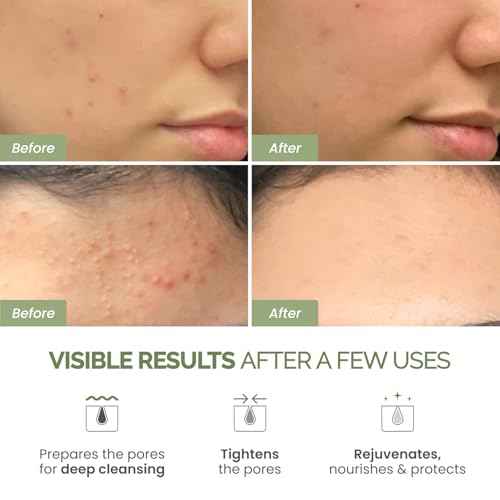 PLANTIFIQUE Korean Skincare Clay Mask ? Hydrating Mud Mask with Avocado & Superfoods, Dermatologist-Tested for Face & Body ? Vegan, 3.4 Oz/100ml