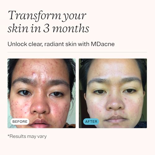 MDacne 3 Step Benzoyl Peroxide Acne Kit - Benzoyl Peroxide Cream 2.5%, Salicylic Acid Cleanser, Niacinamide Moisturizer - Medicated Plant-Based kit for Adult & Teen Acne, 60 Day Kit + Pimple Patches