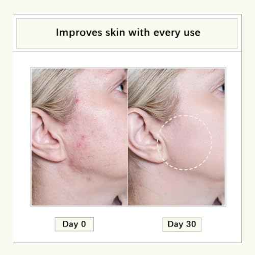 Cistto Natural Cleansing Oil Lightweight Balancing Makeup Remover with Jojoba & Rose Oil, Non-Comedogenic, Travel-Friendly 2ml x 40 Capsules for Oily Skin